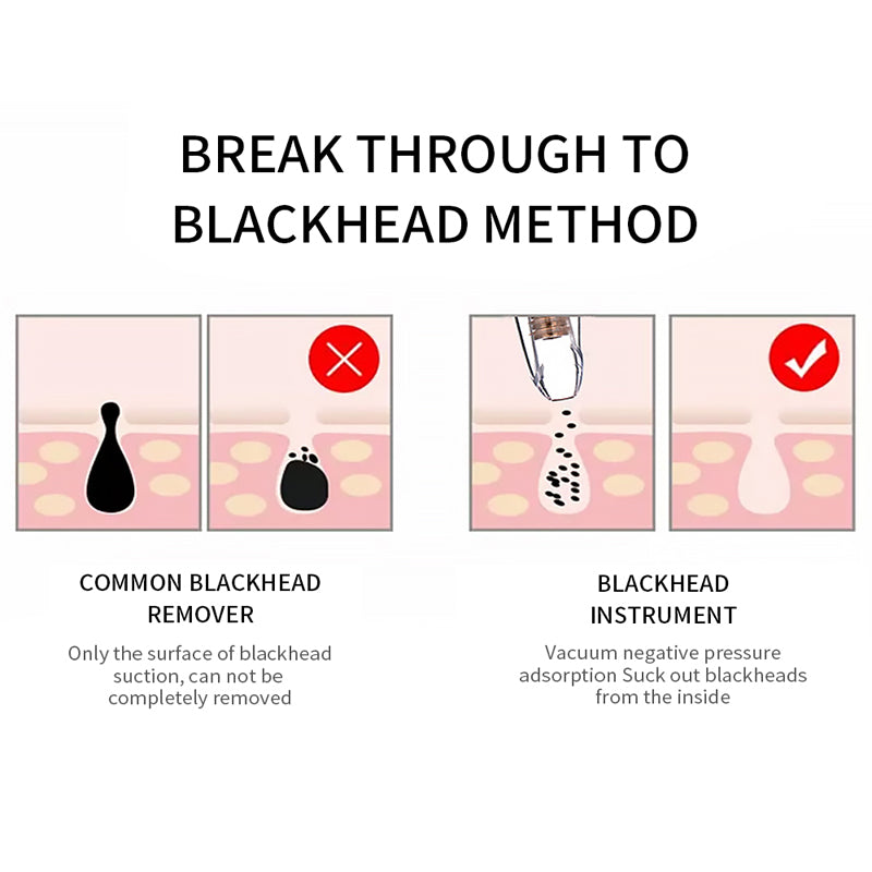 Blackhead Remover Vacuum Suction Deep Pore Facial Cleaning Tool
